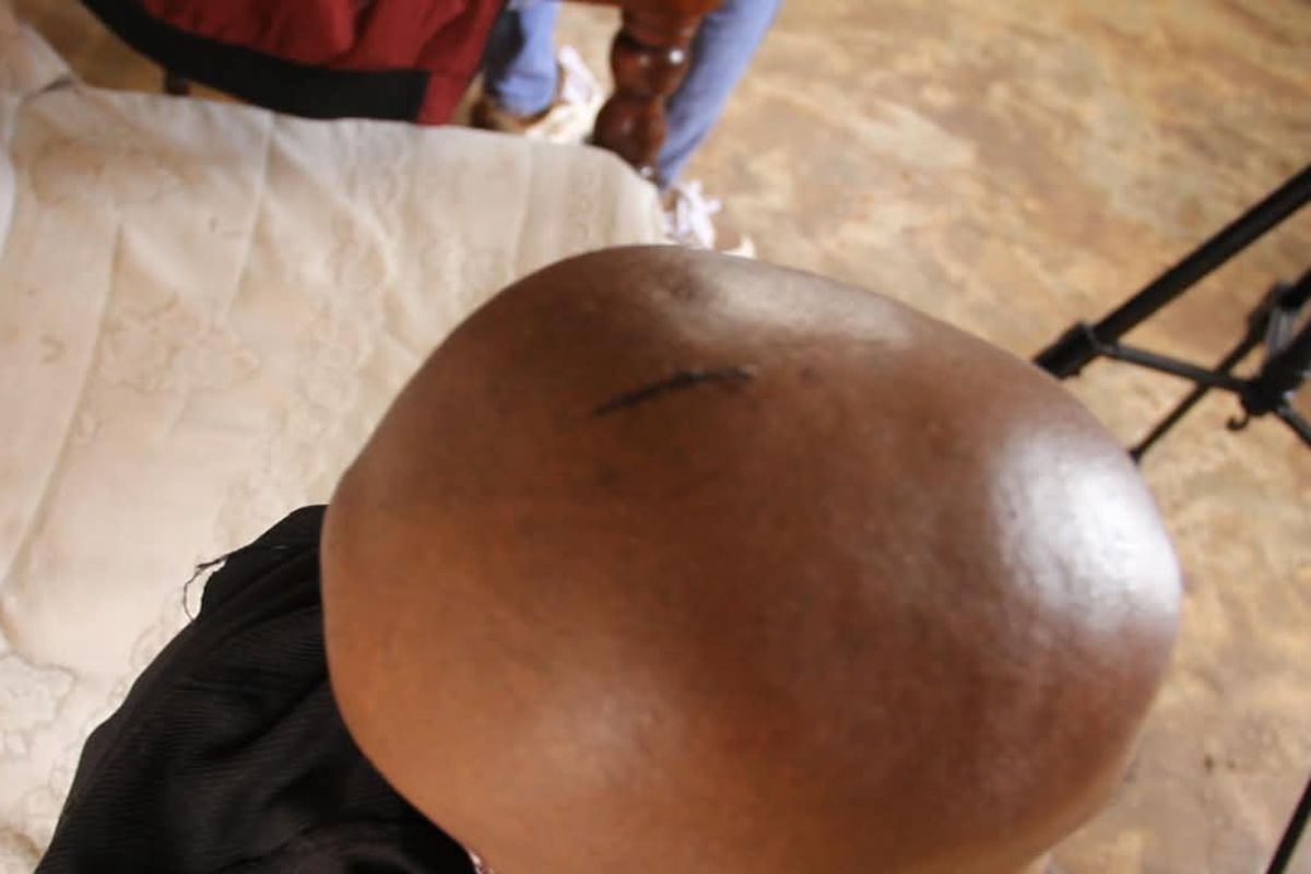 Baba mbaroni tuhuma za kumjeruhi mwanaye kichwani